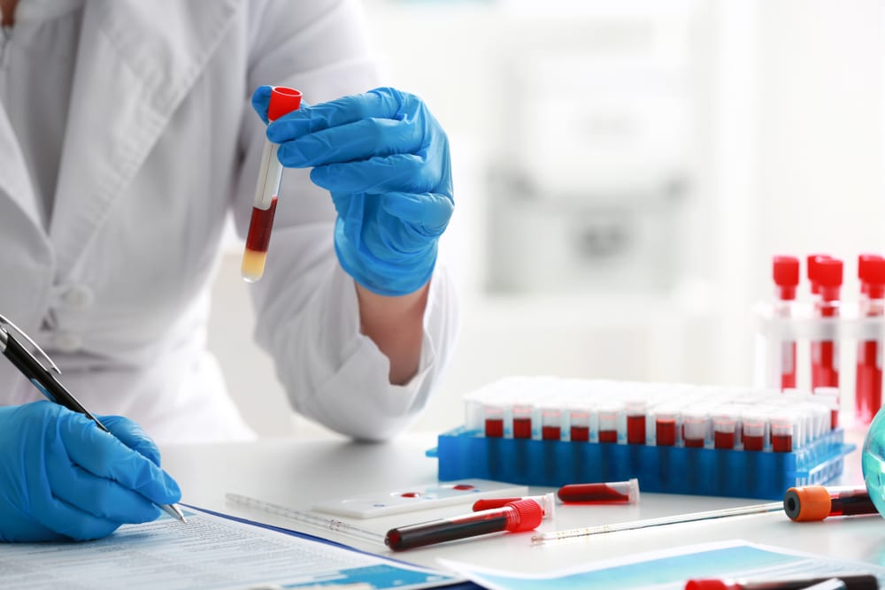 A veterinarian wearing a white lab coat and blue gloves holds a blood sample vial while writing on a clipboard at a laboratory table with test tubes and samples.